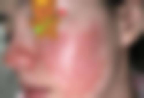 四、太原德尔美客医疗美容诊所特色项目