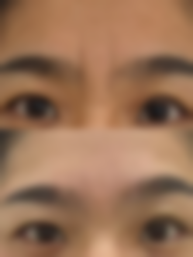 五、成都润美玉之光陶丁医生技术怎么样？