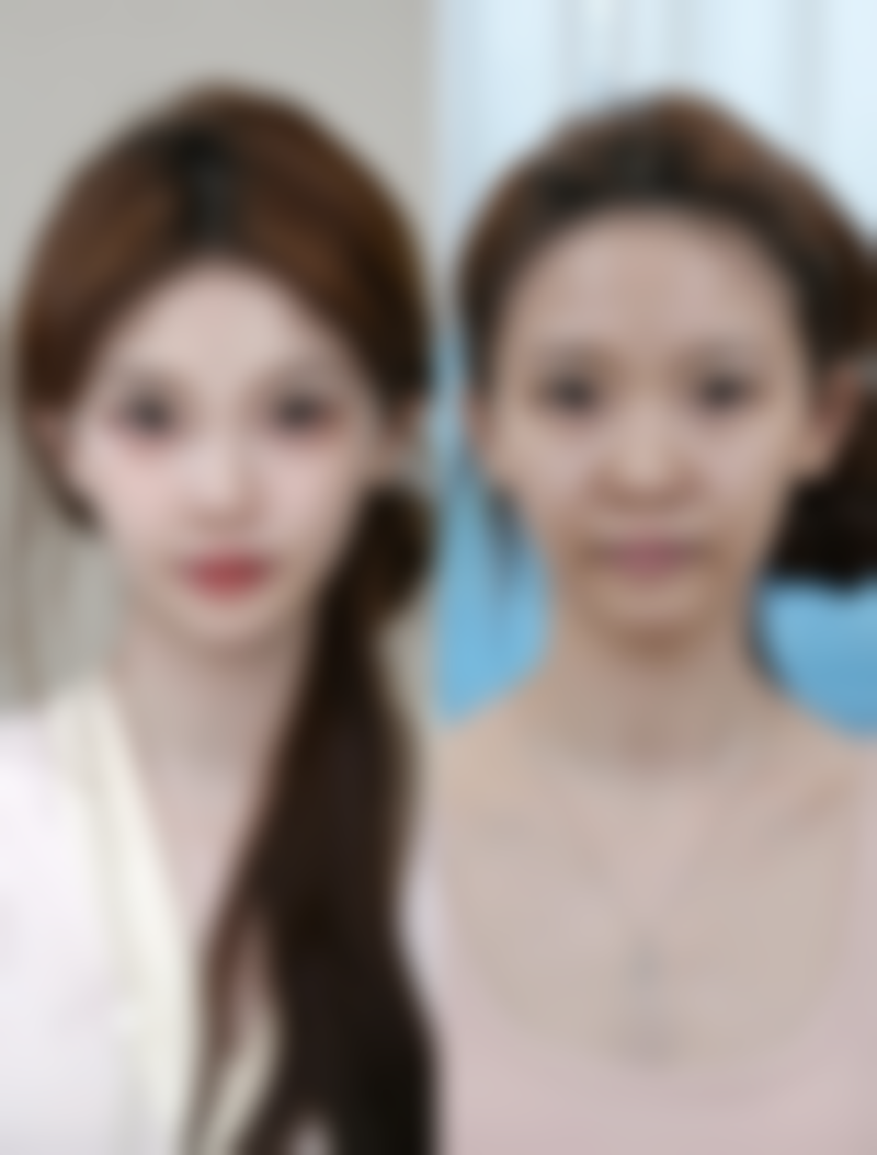 四、重庆重庆医 科 大学附属医院整形美容果磊医生坐诊医院