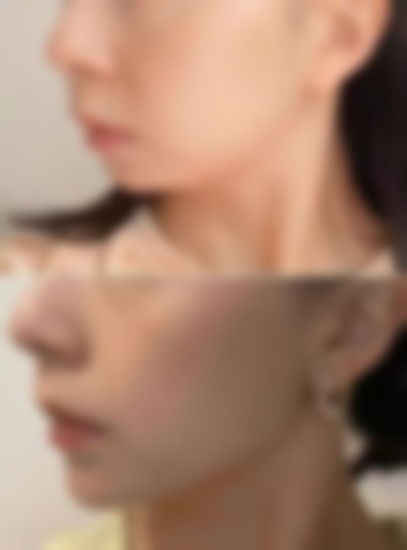 八、上海盈健整形医院怎么预约？