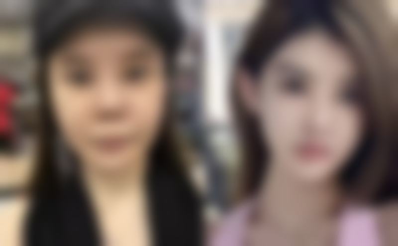 多款产品推荐助你改善眼袋！