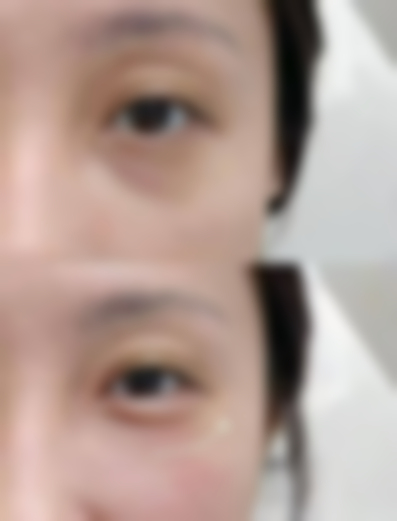 二、成都润美玉之光何倩医生擅长项目