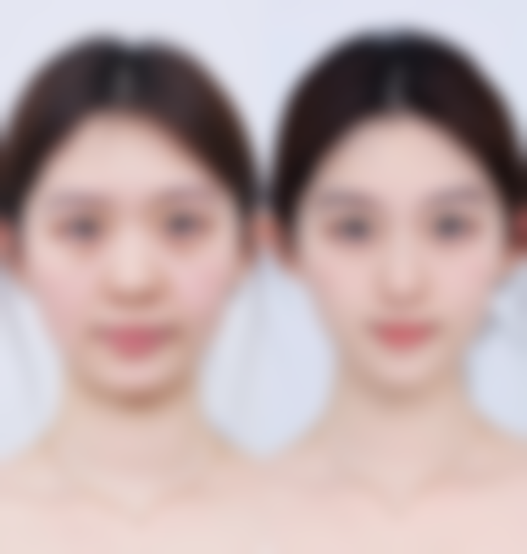 七、成都润美玉之光郭增医生怎么预约?