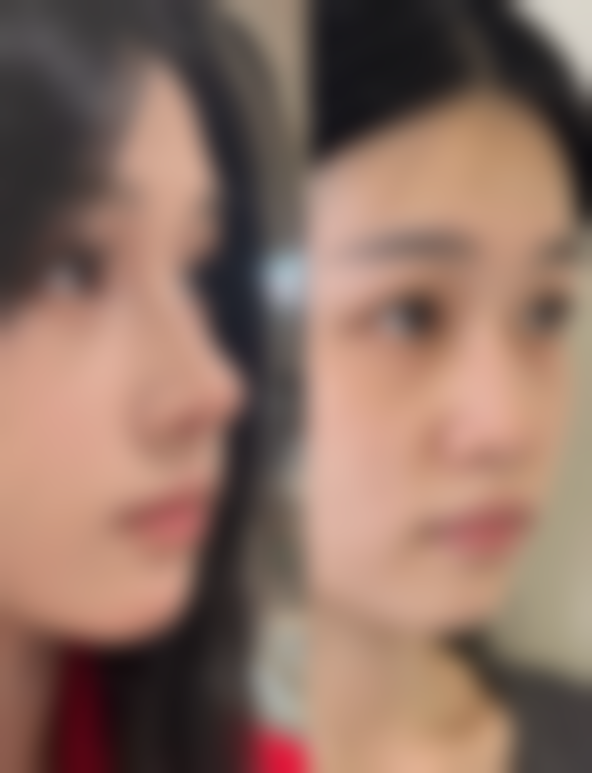 国内综合实力强的去眼袋医院