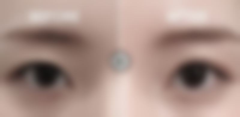 八、上海奇致芊晶整形医疗美容门诊部怎么预约？