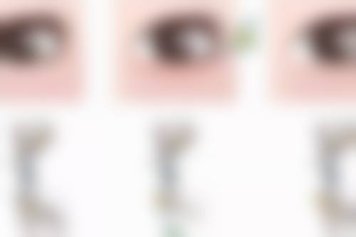 韩国me双眼皮好不好？它效果持久创伤小，但也有消肿久等问题，选前需综合考量！ 