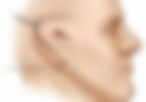 夫妻都是双眼皮孩子会是单眼皮吗？有可能，受基因、发育等因素影响，还需留意异常症状！ 