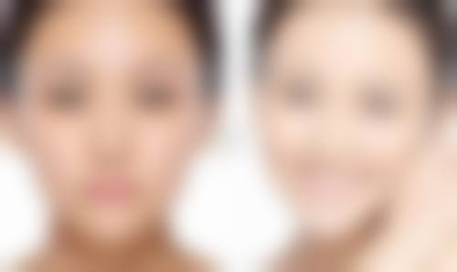 四、广州瑞美医疗美容黄艳红医生坐诊医院