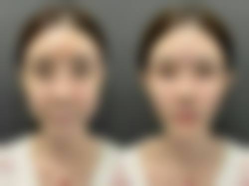 五、青岛伊美尔国宾整形外科付恩阳医生技术怎么样?