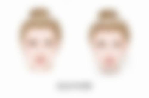 五、青岛伊美尔国宾整形外科王宏燕医生技术怎么样？