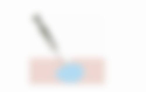 正规机构操作更有保护