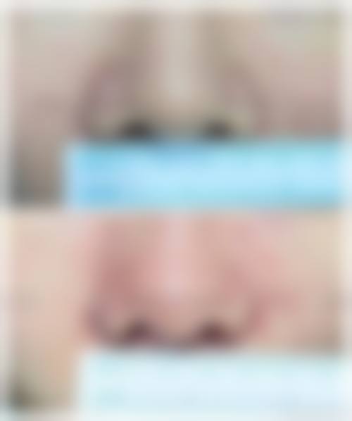 八、南昌华瑞医疗美容医院怎么预约？