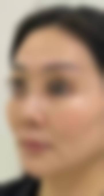 五、宜昌伊莱美整形美容医院收费价格表