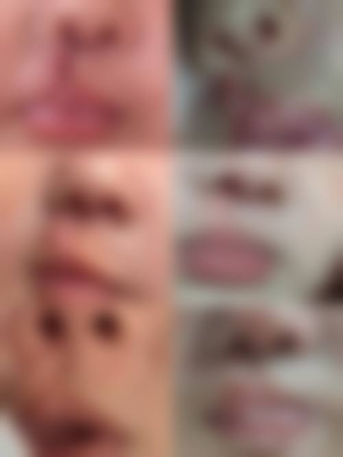 八、南京辰悦医疗整形医院怎么预约？