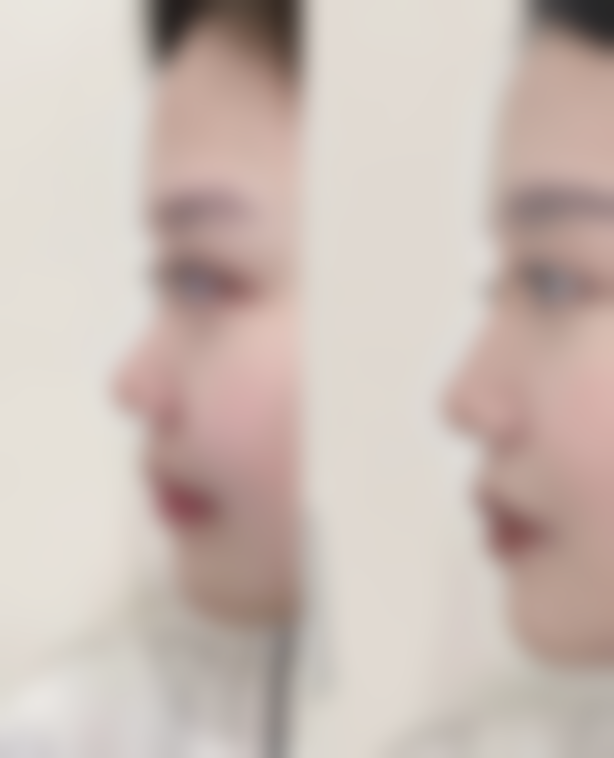 八、桂林美丽焦点医疗美容怎么预约？