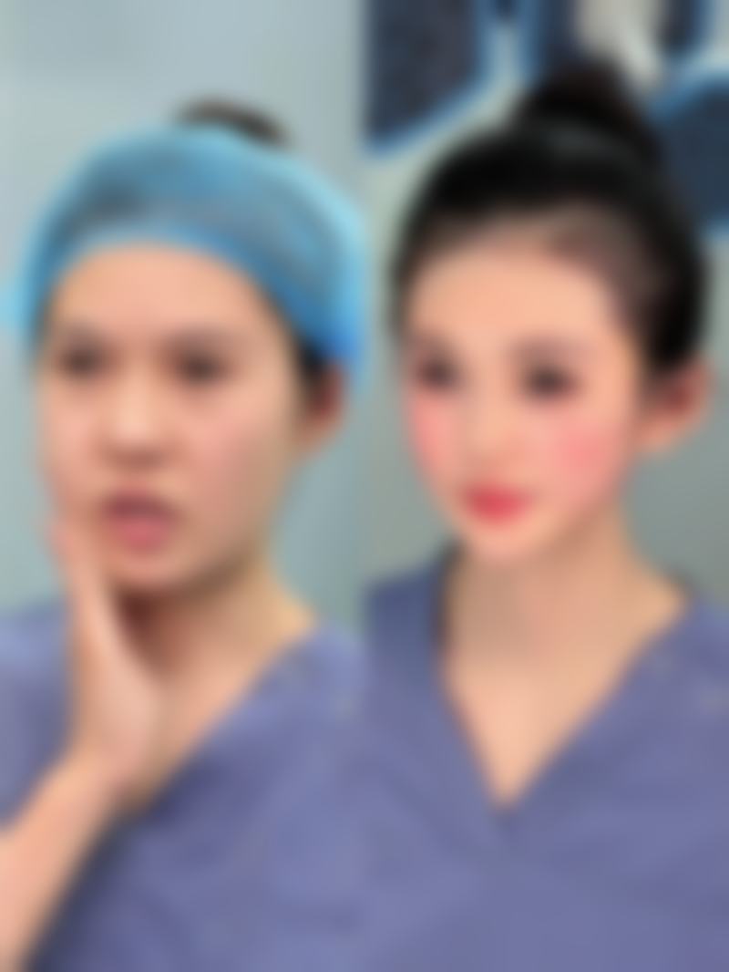 物理治疗凸起疤痕