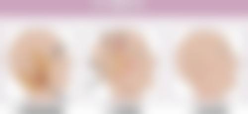 五、青岛伊美尔国宾整形外科单文涛医生技术怎么样？