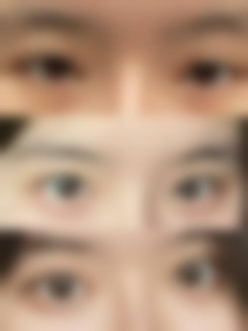 八、昆山虹桥整形医院怎么预约？