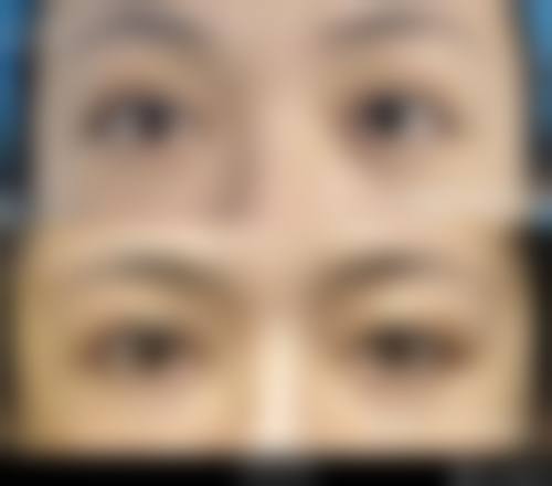 五、深圳四季木兰医疗美容诊所收费价格表