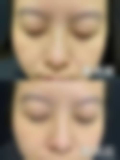 五、丽珈医疗美容门诊部收费价格表