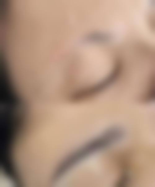 四、四川成都艺美汇植发特色项目