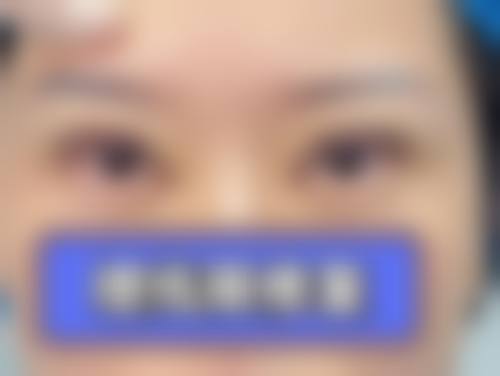 四、三河初悦佳人医疗美容诊所特色项目