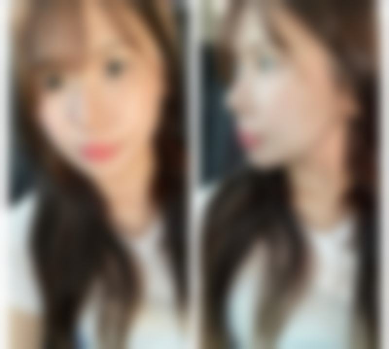 八、杭州美天美整形医院怎么预约？