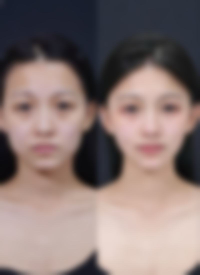 七、青岛伊美尔国宾整形外科孙晓彤医生怎么预约?