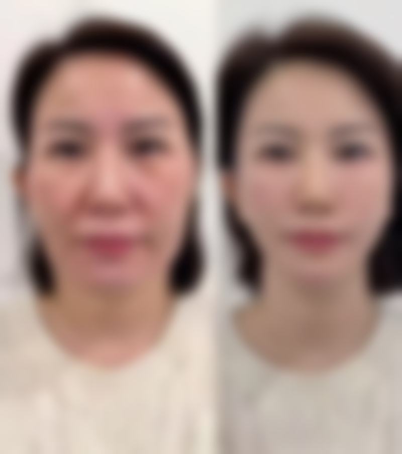 四、海口琼山亿佳医医疗美容门诊部特色项目