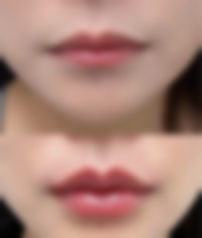 六、长沙爱薇尔医疗美容医院口碑如何?