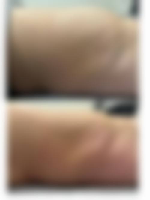 八、福州添媛美整形美容门诊部怎么预约？