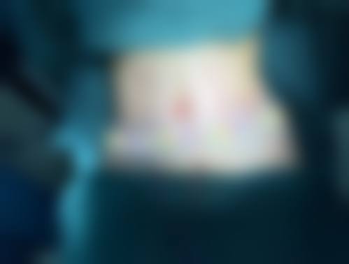 四、邢台博爱整形医院特色项目