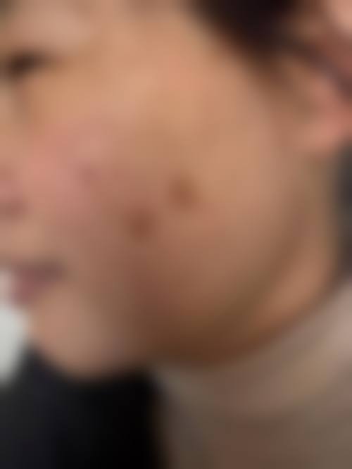 八、清潭美乐皮肤科怎么预约？