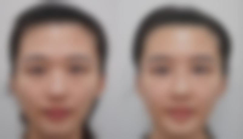 五、广元艾可儿再生医疗美容诊所收费价格表