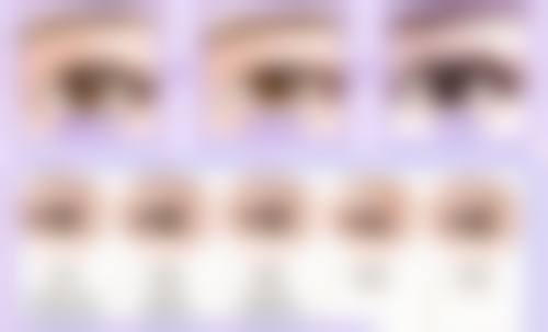 怎么就可以去眼袋？日常护理、物理治疗、手术治疗等多方法揭秘，助您告别眼袋烦恼！ 