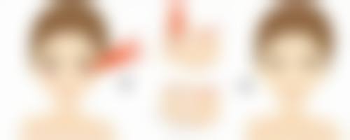 长痘痘留的疤痕怎么去除？激光治疗有奇效