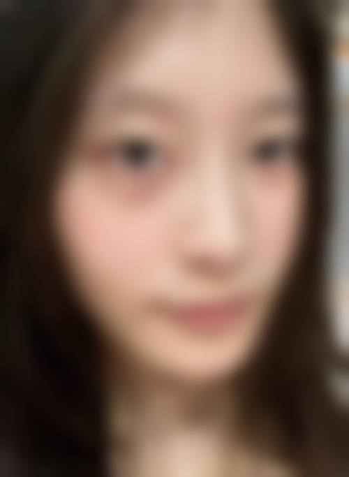 四、马鞍山容妍医疗美容诊所特色项目