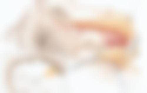 手术治疗,重度眼袋的选择