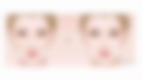 修复状况决定休息时间长短