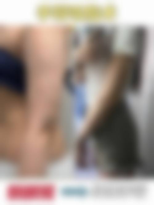 六、临沂璞愈整形医院口碑如何？