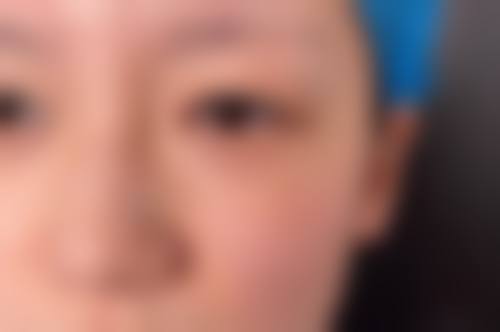 六、郑州惠美医疗美容门诊部口碑如何？