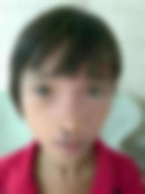 八、涪城医而美医疗美容门诊部怎么预约？