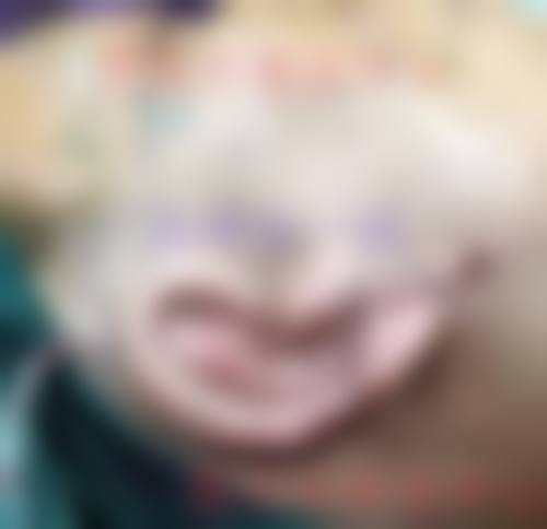 八、邯郸市中 心医院(烧伤整形科)怎么预约?