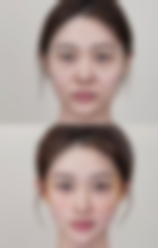 疤痕老是痒怎么办？一般治疗、药物治疗、物理治疗等方法来帮忙，严重时需就医！ 