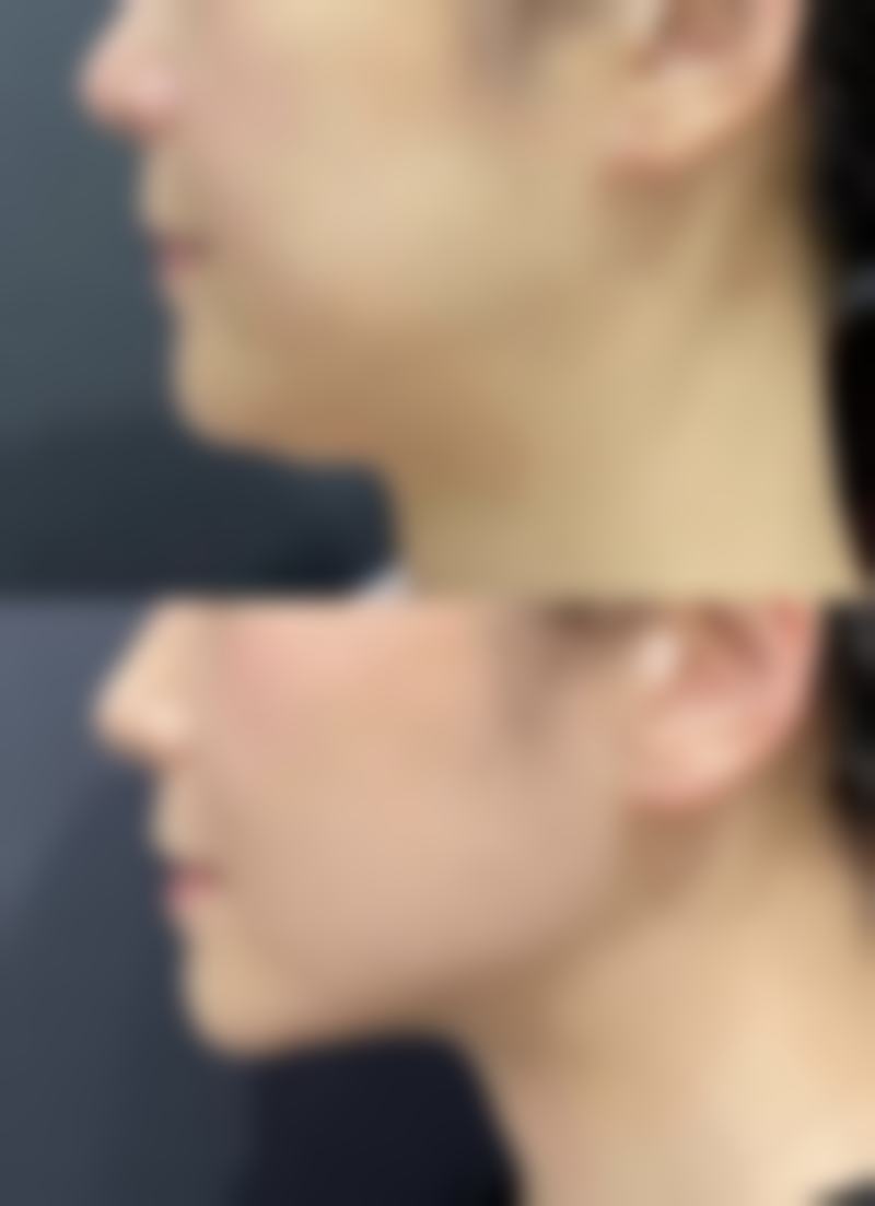 七、徐州京城皮肤病医疗美容陈铁琳医生怎么预约？