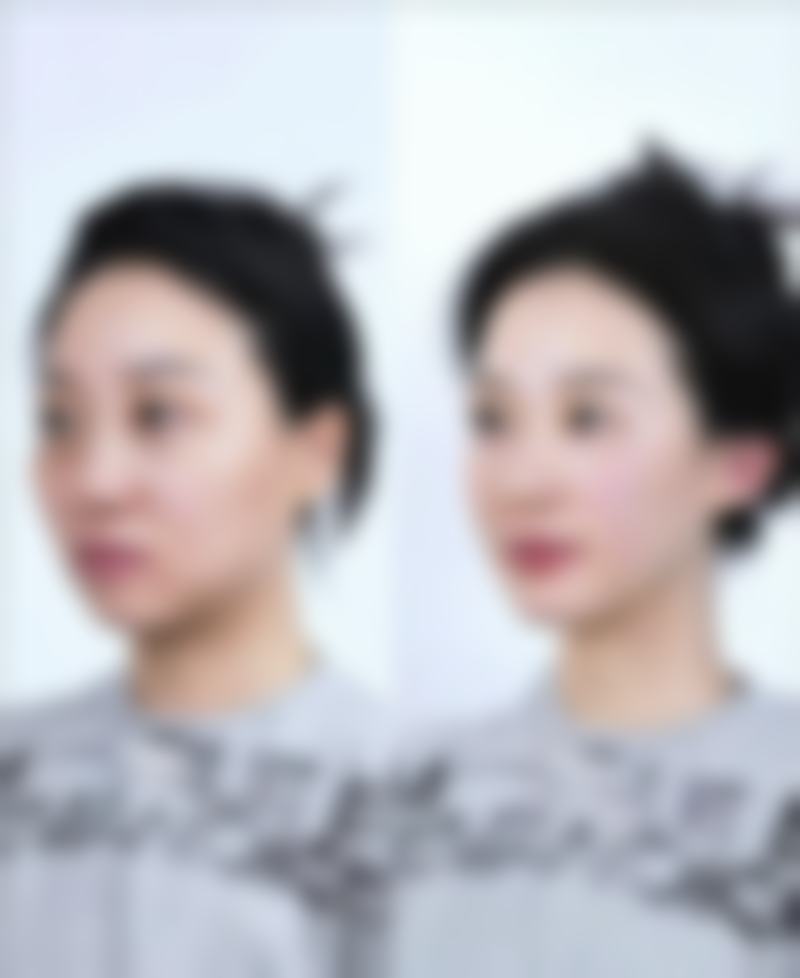 六、徐州京城皮肤病医疗美容曹赐斌医生口碑评价及真人实例反馈