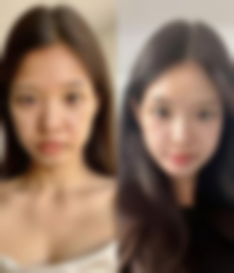 二、ThawipornTriprapakorn医生擅长项目