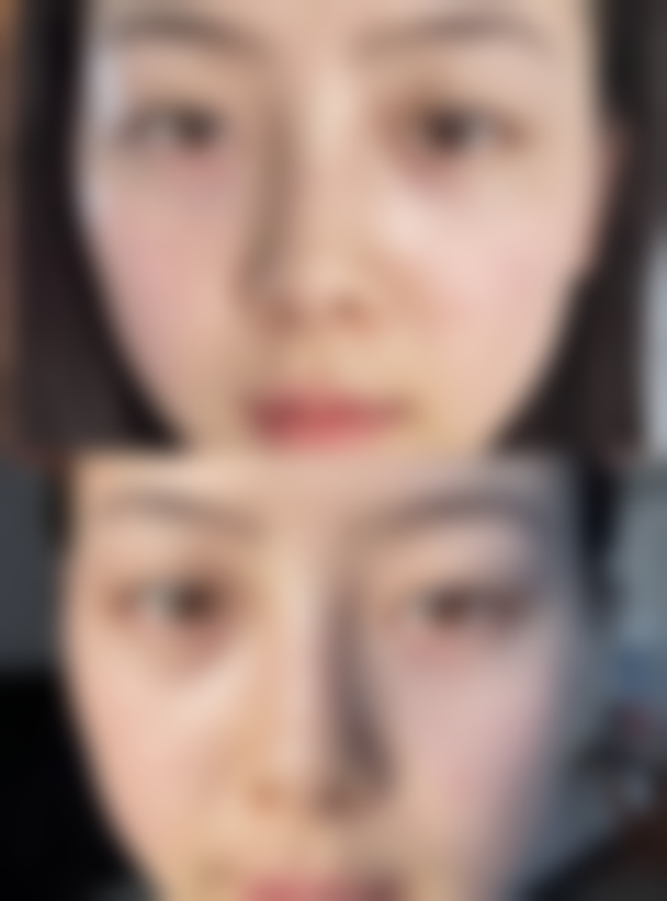 七、徐州京城皮肤病医疗美容张英睿医生怎么预约?