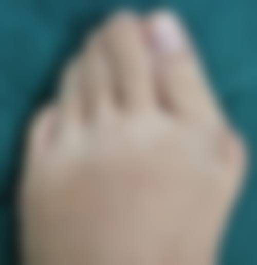 二、长沙艾美尔医疗美容李烈梧医生擅长项目