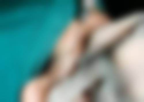 六、徐州京城皮肤病医院医疗美容曹赐斌医生口碑评价及真人实例反馈